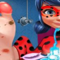 Ladybug Foot Surgery - An excellent surgery on foot